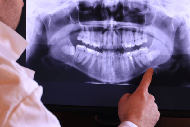 Best Emergency Dental Care for Abscessed Tooth in Apache, OK